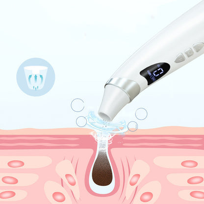 Electric Visual Blackhead Suction Instrument Household Cleansing Pore Cleaner For Skin care Tool