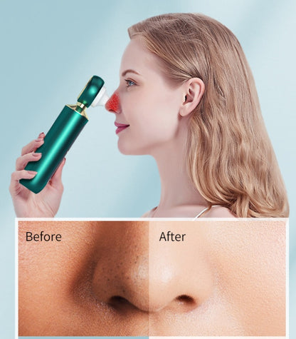 Portable USB Electric Blackhead Remover with Magnifying Glass